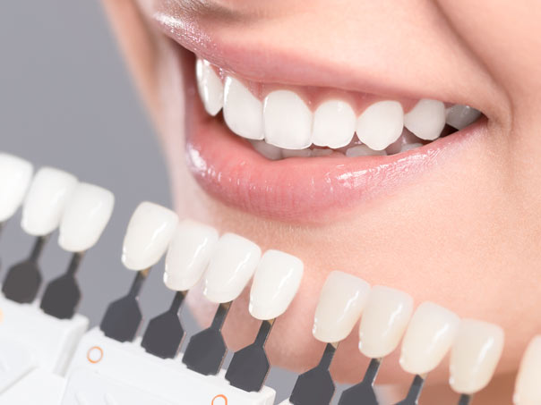 Teeth Whitening Colour Options