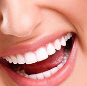 dental implants perth