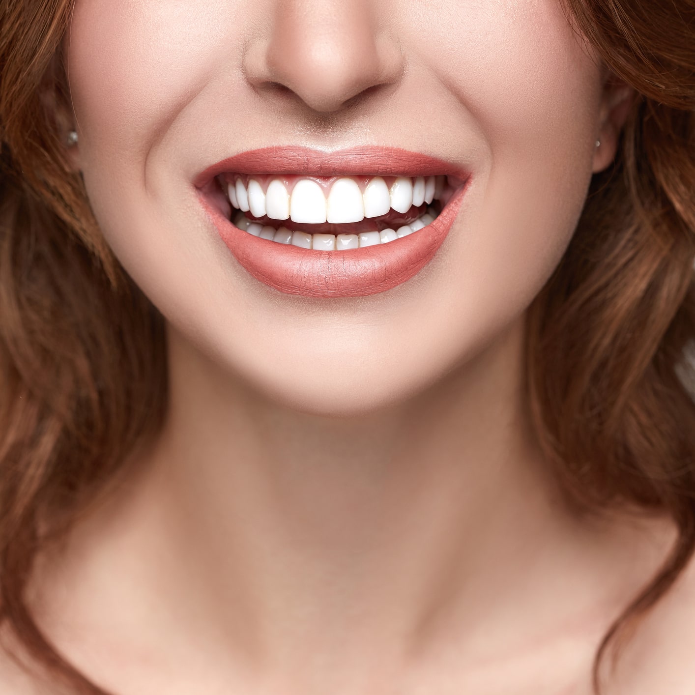 Beautiful smile with bright white teeth and red hair